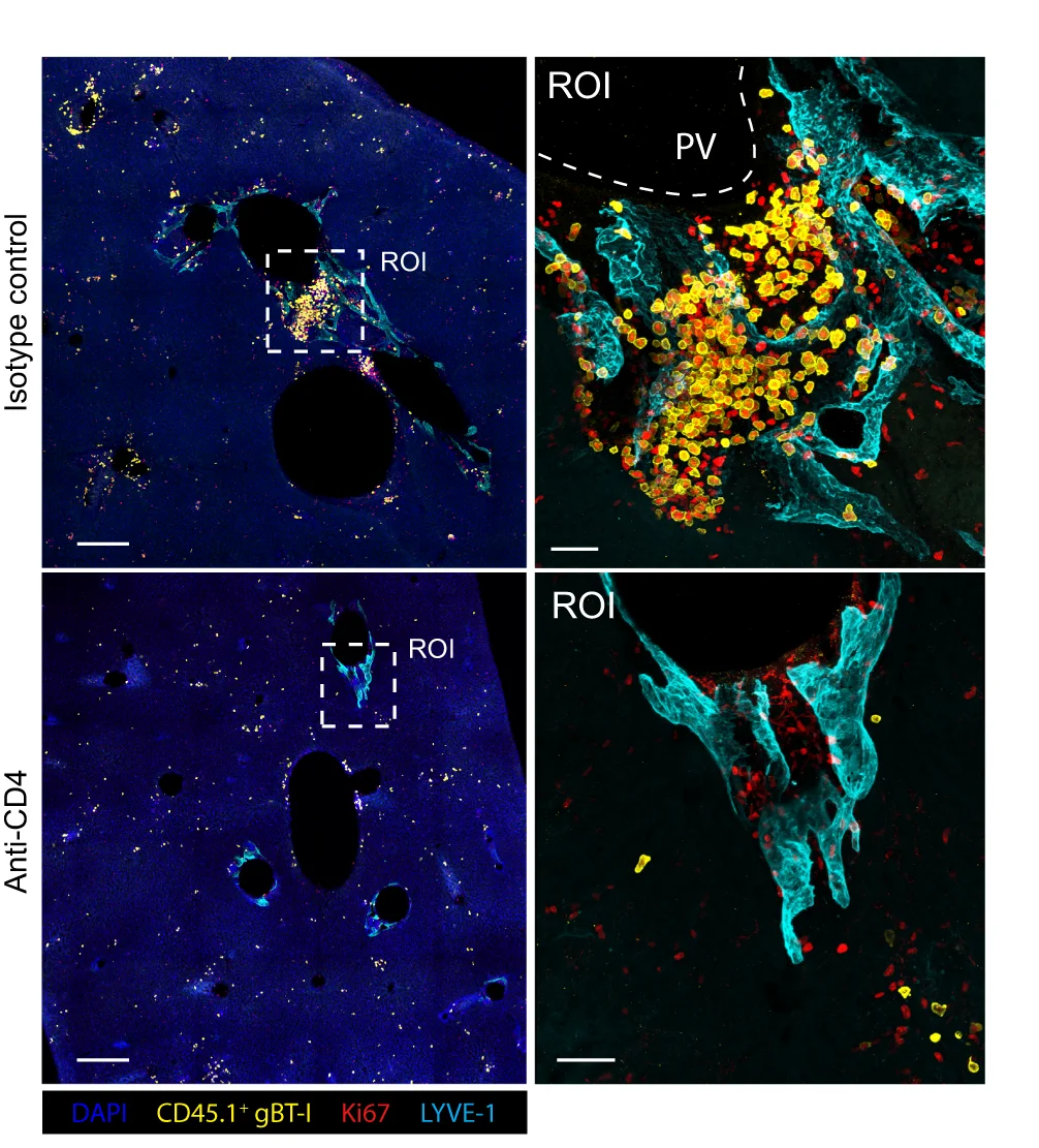 Open access visualization of Microscopy, Immunofluorescent Images, Livers, Isotype Control, CD4 Depleted
