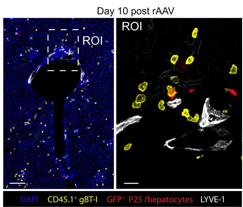 Open access visualization of Microscopy, IF Images, T Cells, rAAV Treatment, Liver
