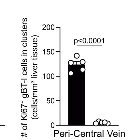 Open access visualization of Bar Plot, Scatter Plot, Ki67 + gB T-1 T Cell Numbers, Clusters in PCV Regions, XCR1 +/+