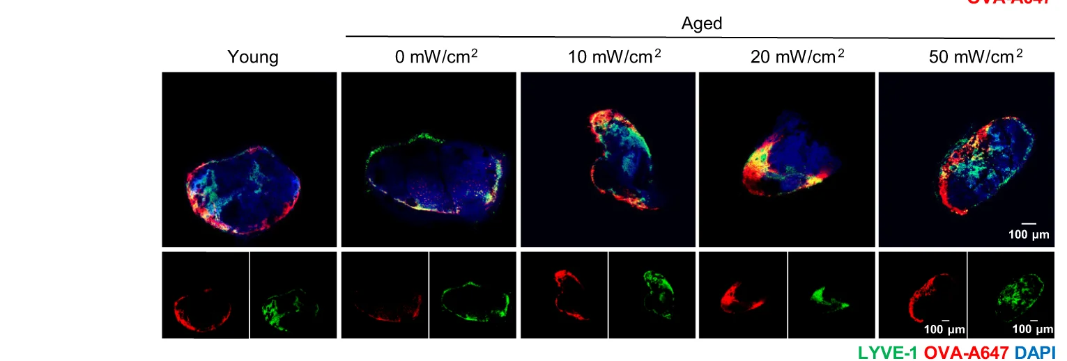 Open access visualization of Microscopy, Section Images, OVA-A647, Deep Cervical Lymph Nodes, LYVE-1