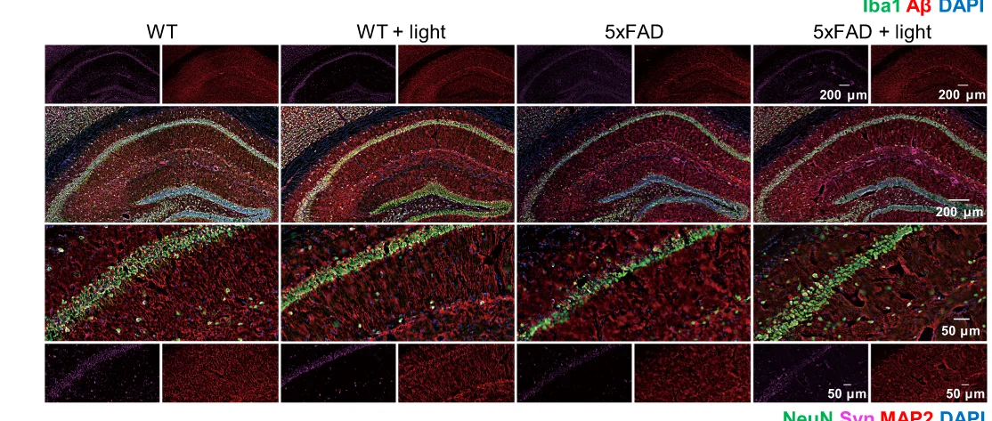 Open access visualization of Microscopy, Brain Sections, Hippocampus, NeuN, Synaptophysin