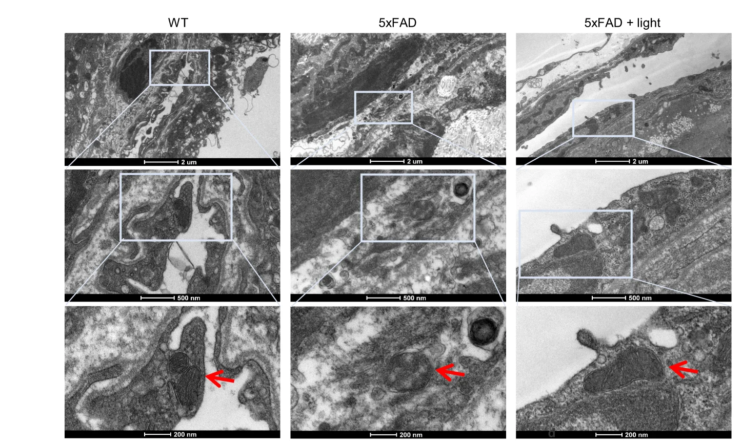 Open access visualization of Microscopy, Transmission Electron Microscopy, mLEC Arrangement, Mitochondrial Morphology