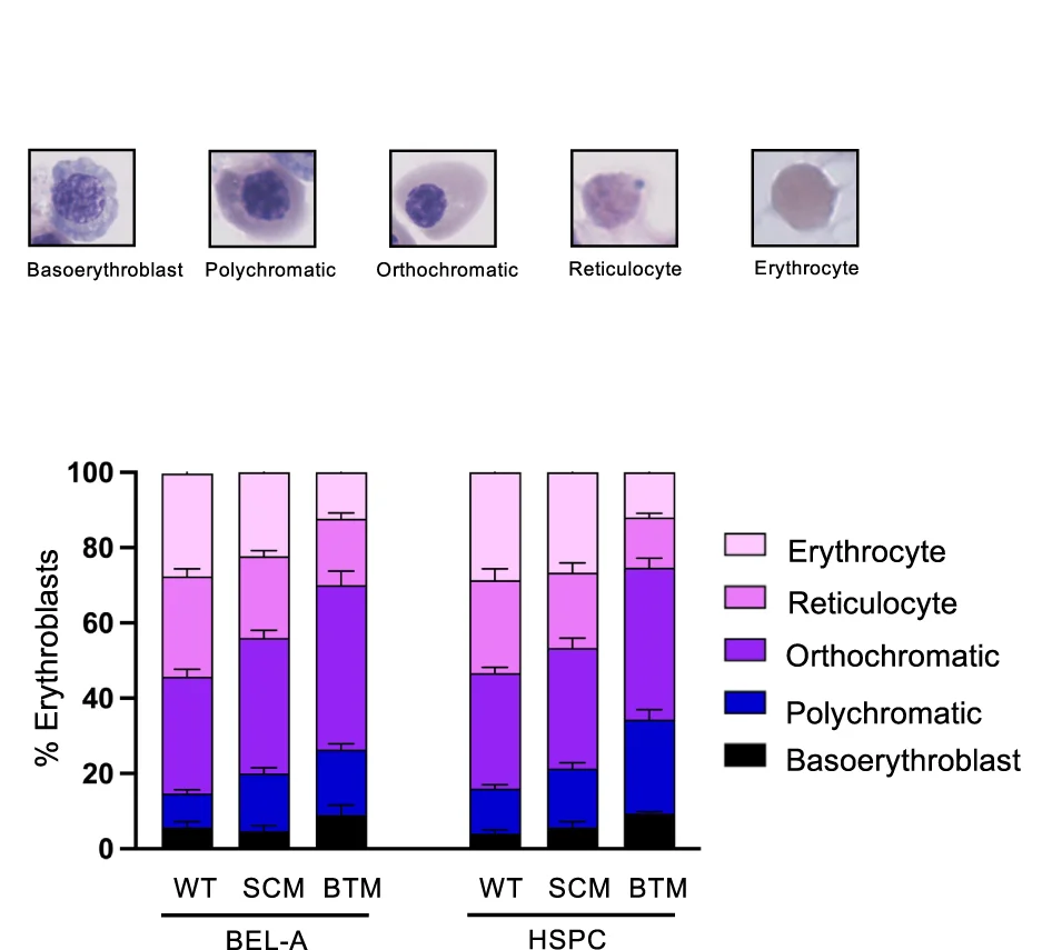 Open access visualization of Stacked Bar Plot, Error Bars, Photo, Microscopy, Giemsa Images