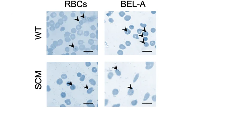 Open access visualization of Microscopy, Giemsa Microscopic Images, Parasite Invasion, RBCs, Reticulocytes