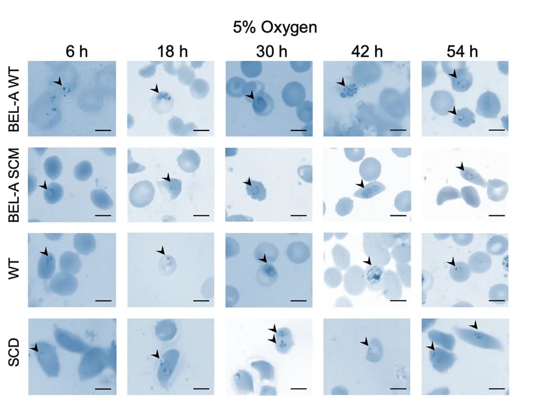 Open access visualization of Microscopy, Microscopic Images, Giemsa-Stained Smears, Parasite Invasion Assay, 5% O2 Condition