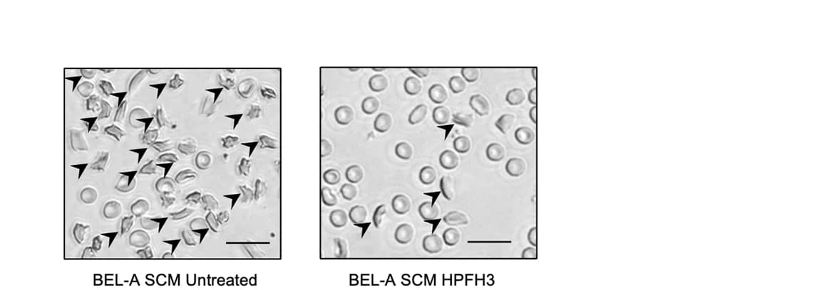 Open access visualization of Microscopy, Microscopic Images, Sickling, BEL-A SCM Cells, Differentiated Cells