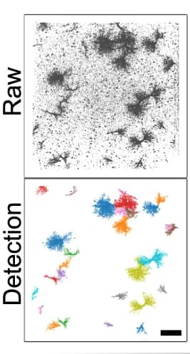 Open access visualization of Microscopy, Super-resolution Localizations, Insulin Aggregation, Aggregate Identification, SEMORE
