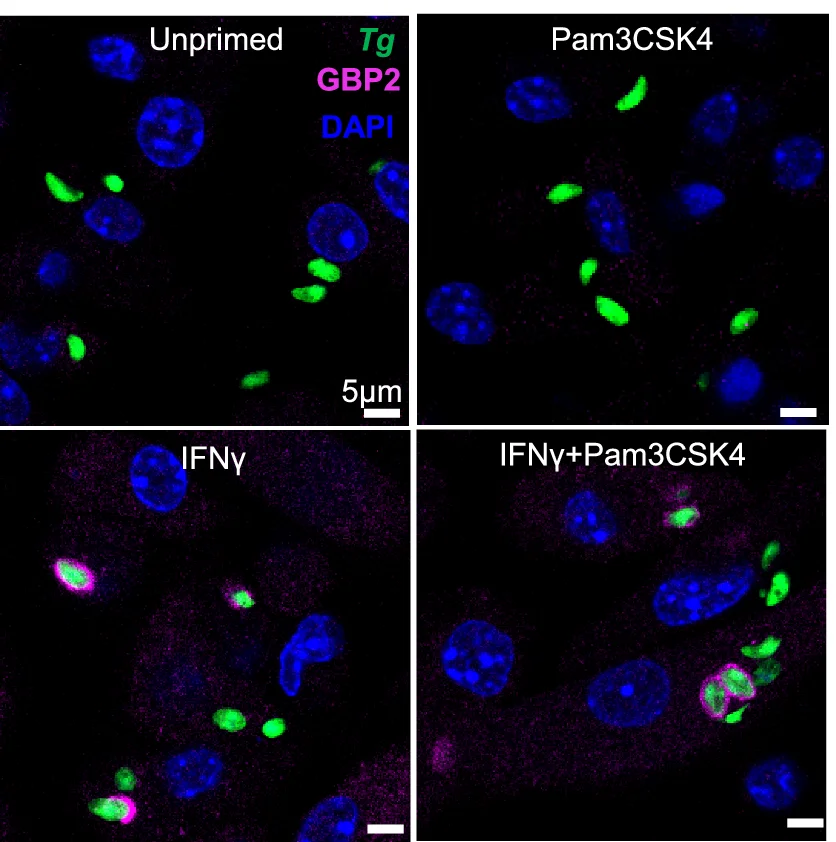 Open access visualization of Microscopy, GBP2, Vacuole, Immunofluorescence Microscopy, DAPI