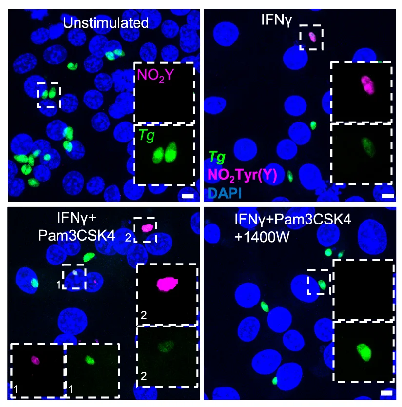 Open access visualization of Microscopy, Nitrotyrosine, Antibody, Co-localization, Parasite GFP