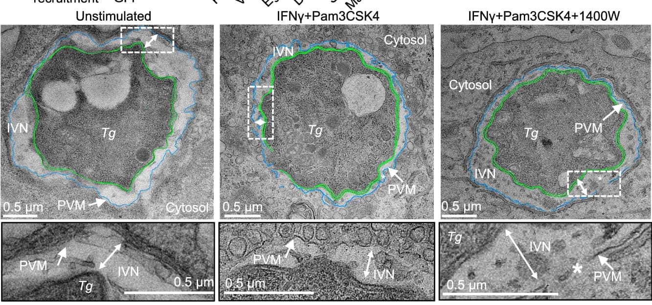 Open access visualization of Microscopy, Vacuole Ultrastructure, TEM, RAW-Cas9 Cells, IFNγ