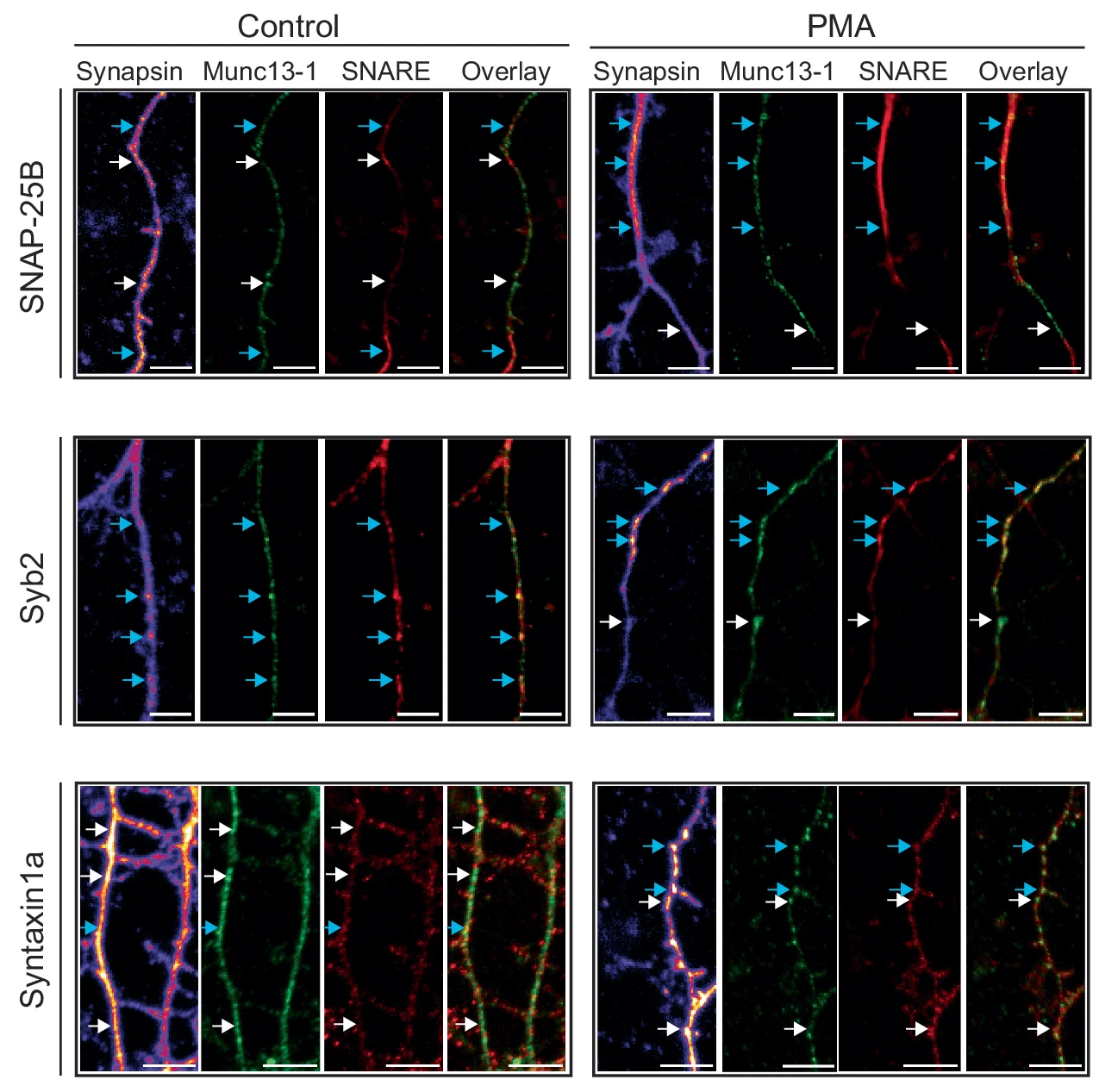 Open access visualization of Microscopy, Cortical Neurons, Synapsin, SNARE Proteins, SNAP-25B