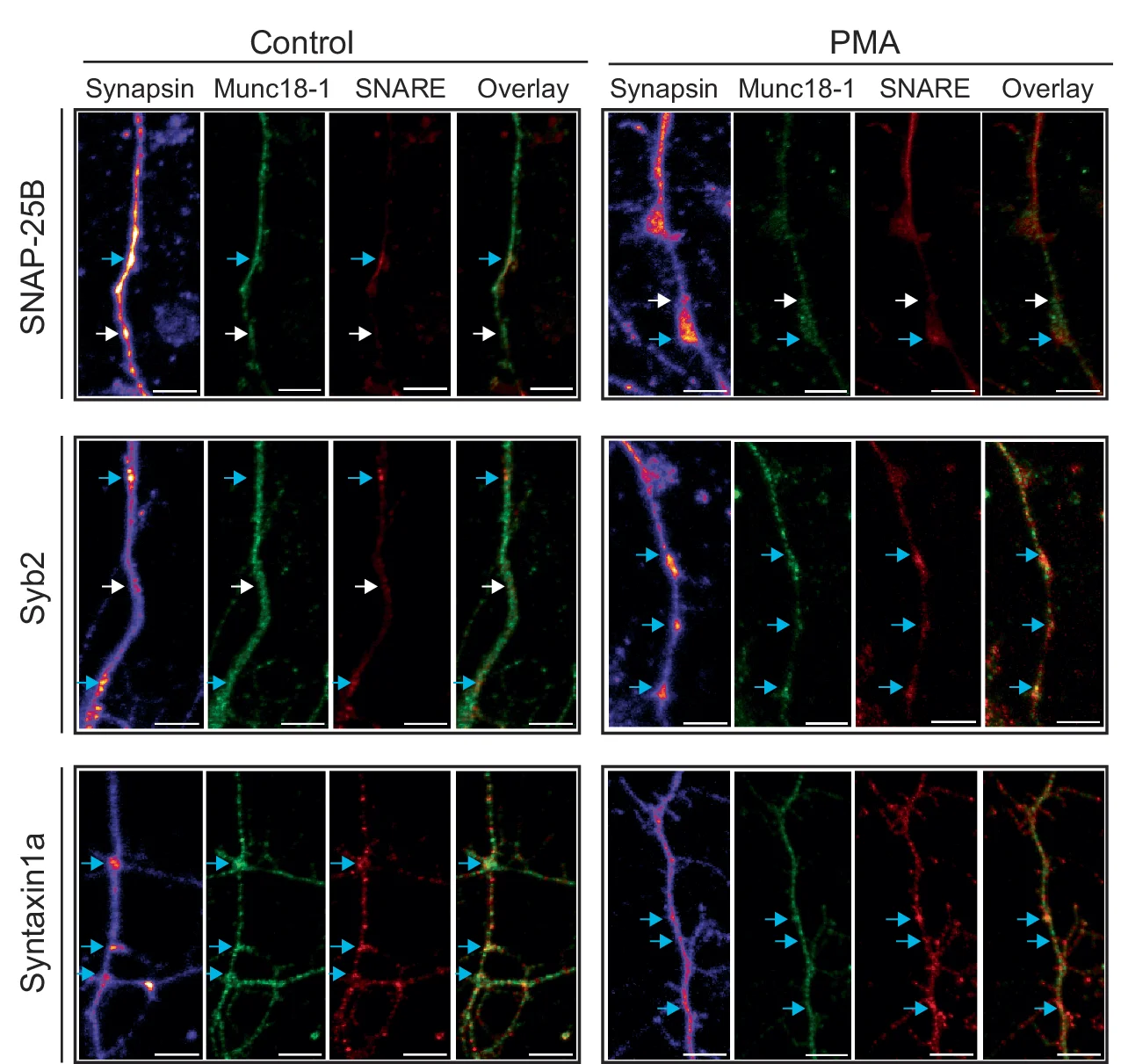 Open access visualization of Microscopy, Cortical Neurons, Munc18-1, Confocal Images, PMA