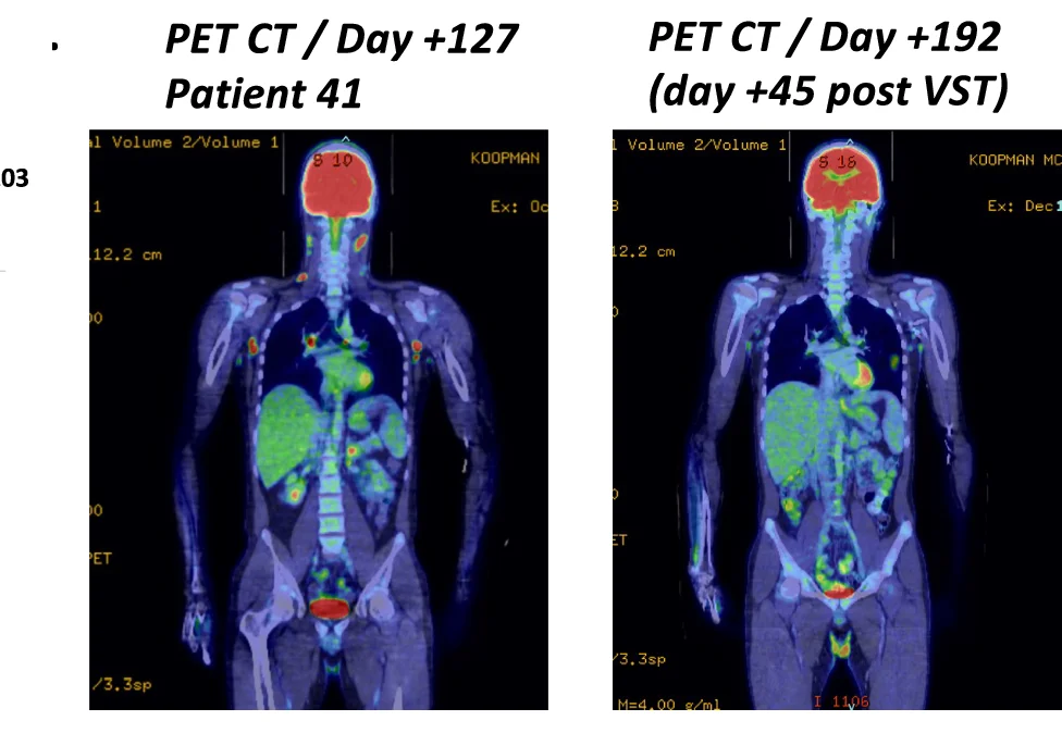 Open access visualization of Photo, PET CT, VST Therapy