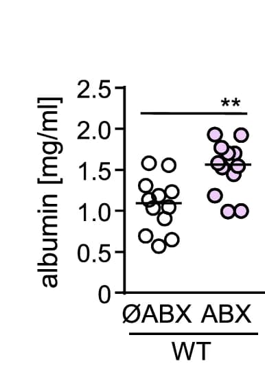 Open access visualization of Scatter Plot, Albumin Levels, Bronchoalveolar Lavage Fluid, BALF, Infected Mice