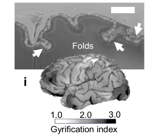 Open access visualization of Microscopy, 3D Plot, Cross-Sectional SEM, Gyrified Structure, Structural Expansion