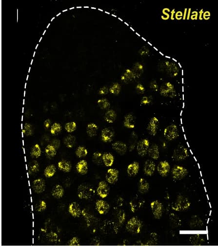Open access visualization of Microscopy, Expression Patterns, Apical Tip of Testis, HCR FISH, Oligonucleotide Probes