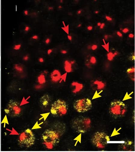 Open access visualization of Microscopy, Nascent Sites of Expression, Su(Ste) Localization, Ste Localization, Higher Magnification