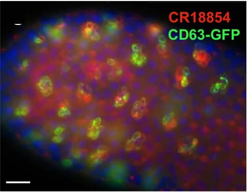 Open access visualization of Microscopy, Double-Labeling, Multivesicular Bodies, Secondary Cells, CR18854