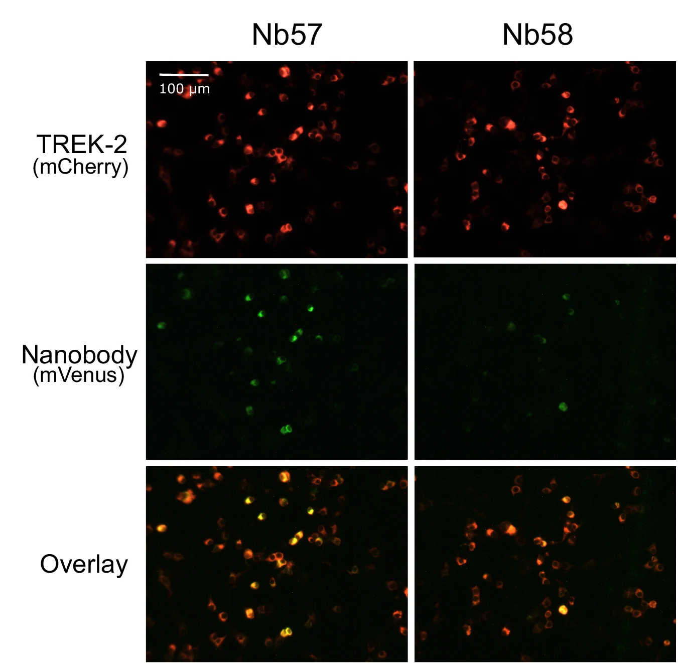Open access visualization of Microscopy, Immunodetection, TREK-2, Cell Surface, HEK-293 Cells