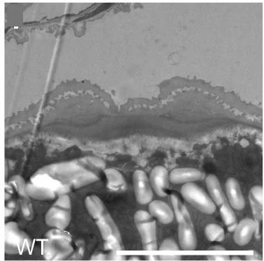 Open access visualization of Microscopy, TEM Images, Mature Pollen, Enlarged Views
