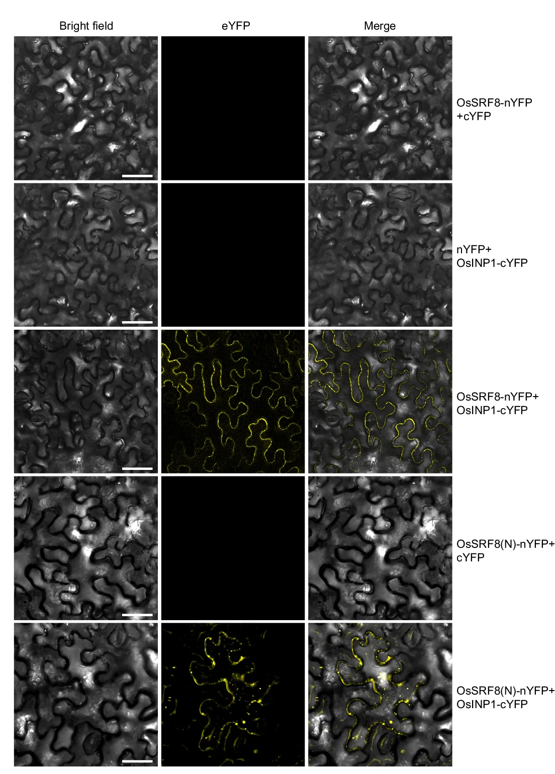 Open access visualization of Microscopy, Bimolecular Fluorescence Complementation, Protein Interaction, YFP, Tobacco Leaves