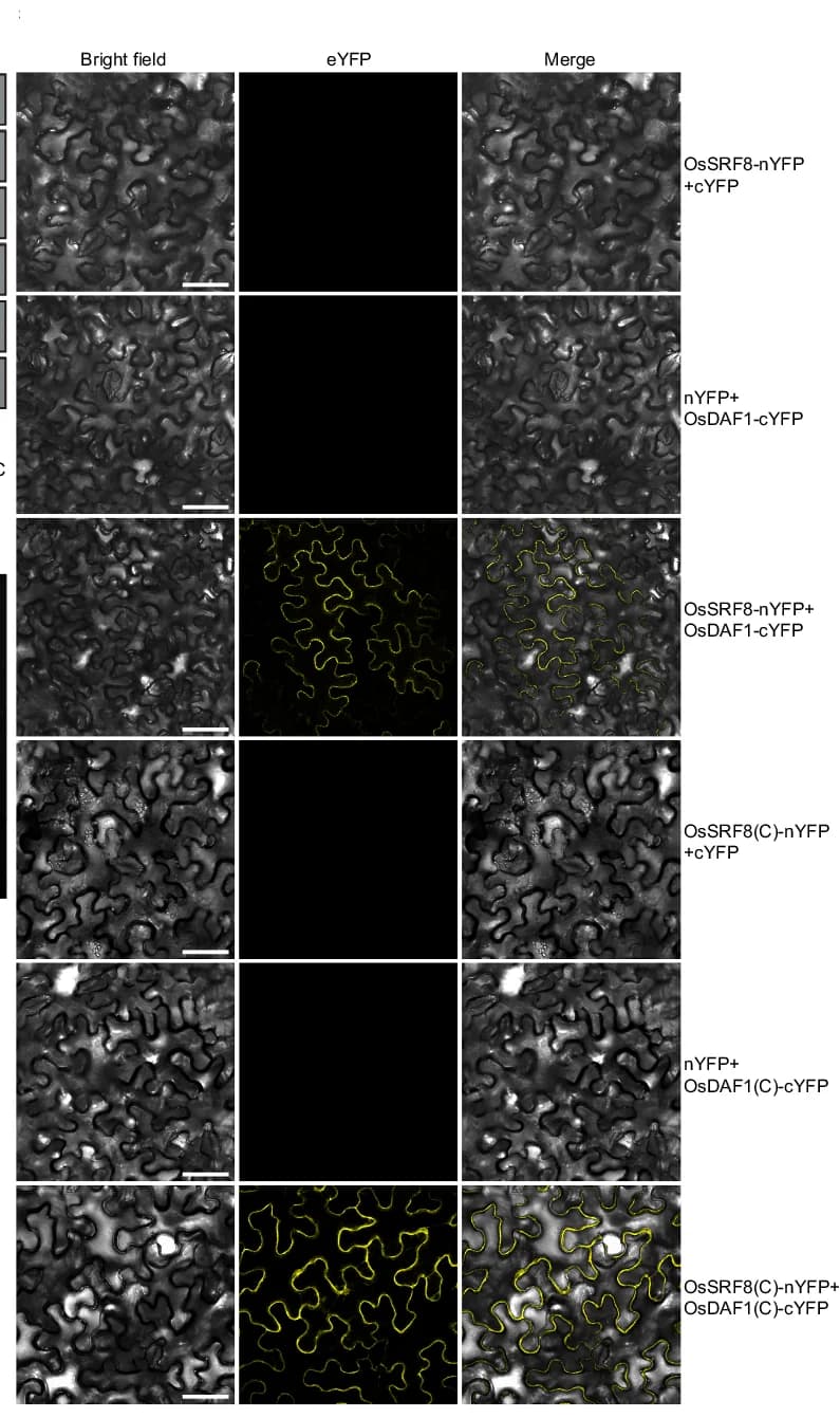 Open access visualization of Microscopy, BiFC Assay, OsSRF8, OsDAF1, YFP