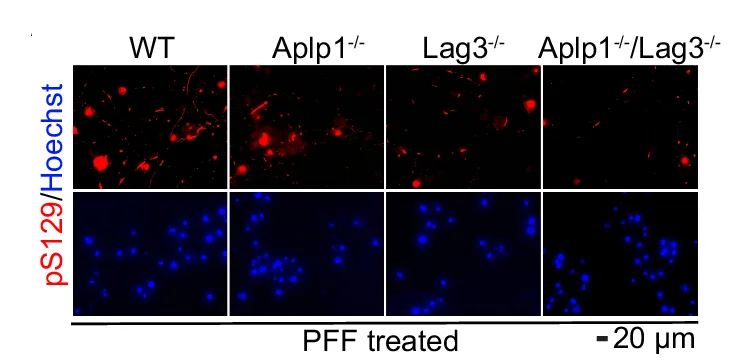 Open access visualization of Microscopy, APLP1, Lag3, pS129 immunostaining, Neurons