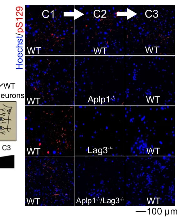 Open access visualization of Microscopy, Photo, Immunostaining Images, pS129, Transmission