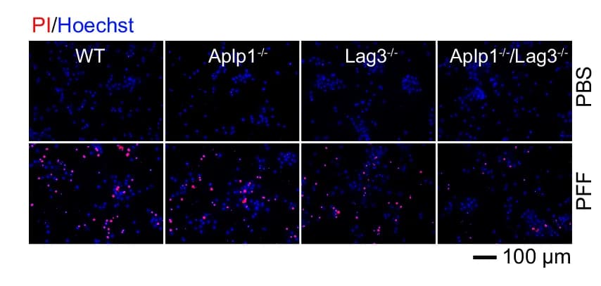Open access visualization of Microscopy, PI/Hoechst Staining, Cell Death, Neurons, APLP1