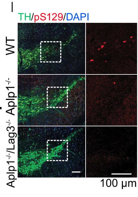 Open access visualization of Microscopy, pS129 Positive Inclusions, Substantia Nigra, WT Mice, Aplp1 Mice