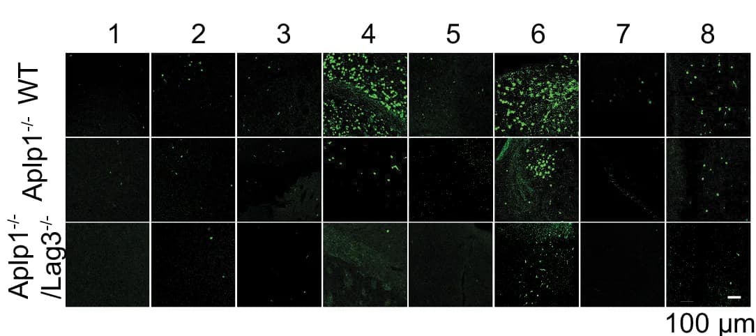 Open access visualization of Microscopy, LB/LN-Like Pathology, pS129 Intensity, Coronal Section, pS129 Staining
