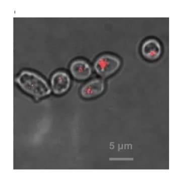 Open access visualization of Microscopy, pTIRF Microscopy, Chimeric Cells, Brightfield Microscopy