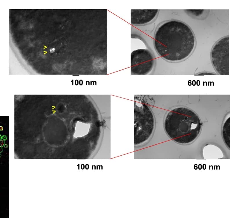 Open access visualization of Microscopy, Transmission Electron Microscopy, TEM, Cyanobacterial Structures, Yeast Cells