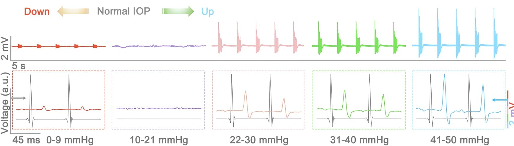 Open access visualization of Line Plot, Gastrocnemius Muscle, IOP Levels, Rat Model, Stimulation Signal