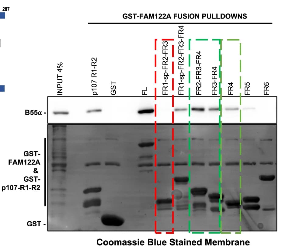 Open access visualization of Gel, GST-FAM122A, Pulldown Assay