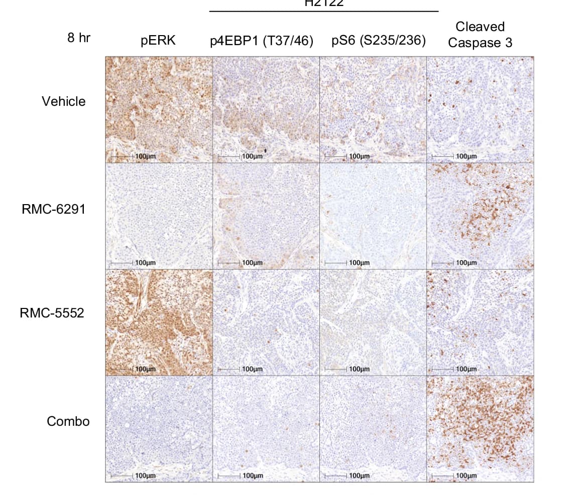 Open access visualization of Microscopy, IHC, H2122 Xenografts, Vehicle, RMC-5552