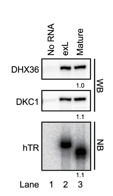 Open access visualization of Gel, Western Blotting, Northern Blotting, In Vitro Assay, Purified Telomerase