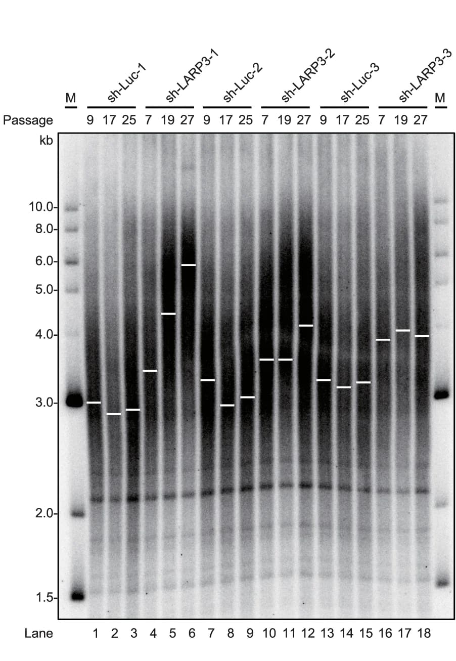 Open access visualization of Gel, Telomere Lengths, TRF Analysis, gDNA, K562 Cells