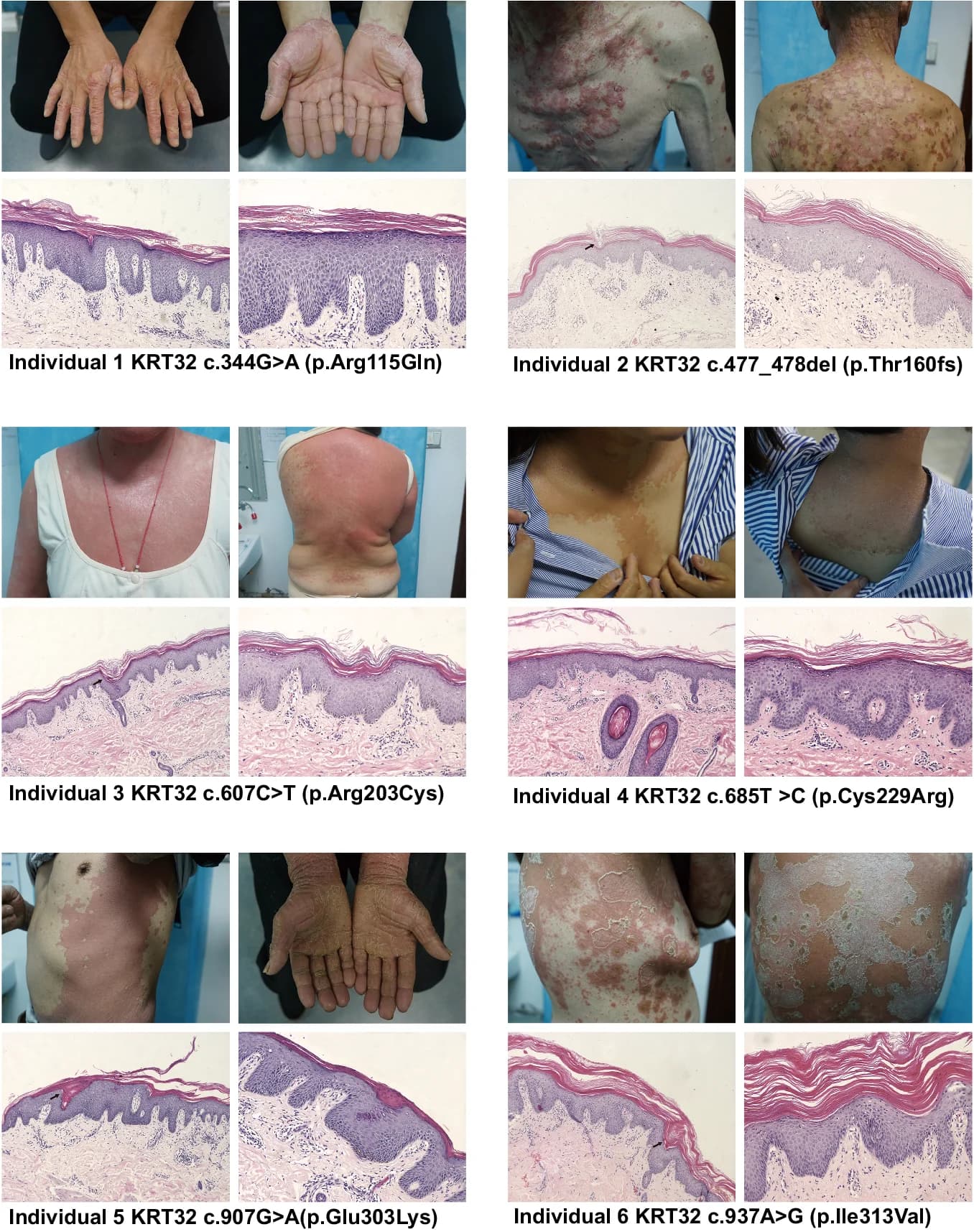 Open access visualization of Microscopy, Photo, Gel, Cutaneous Lesions, Skin Biopsy