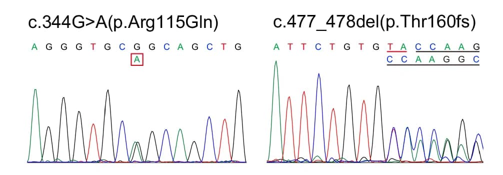 Open access visualization of Line Plot, KRT32, Mutations, Patients, Sanger Sequencing