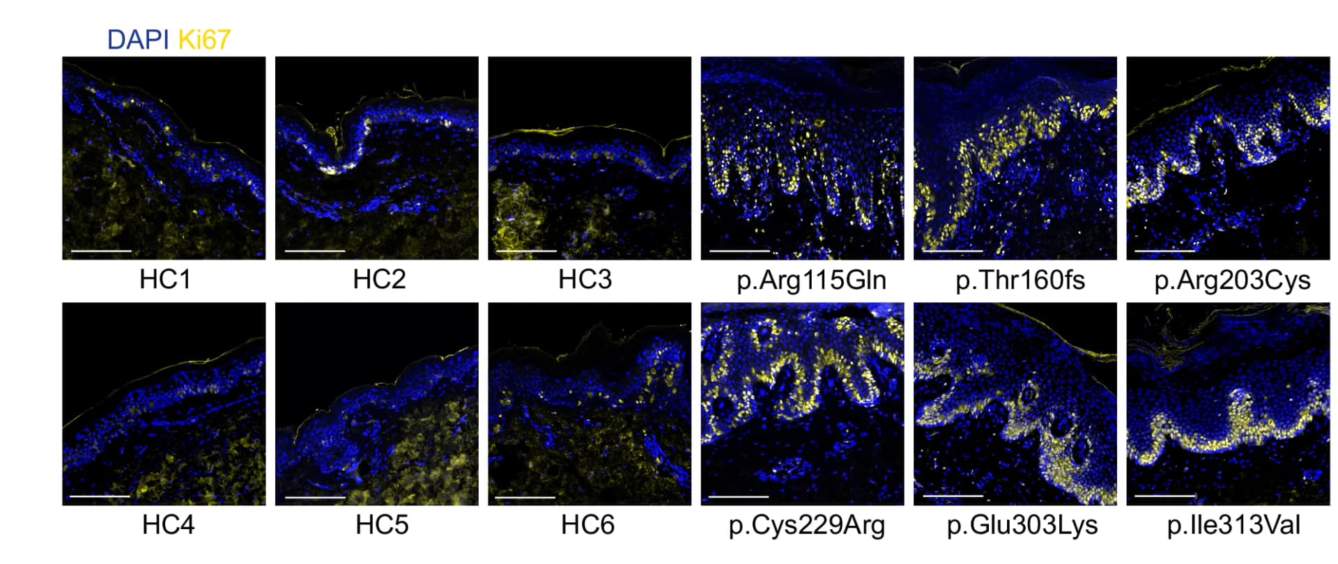 Open access visualization of Microscopy, Immunofluorescence Staining, Skin Biopsy, KRT32 Mutation, Healthy Controls