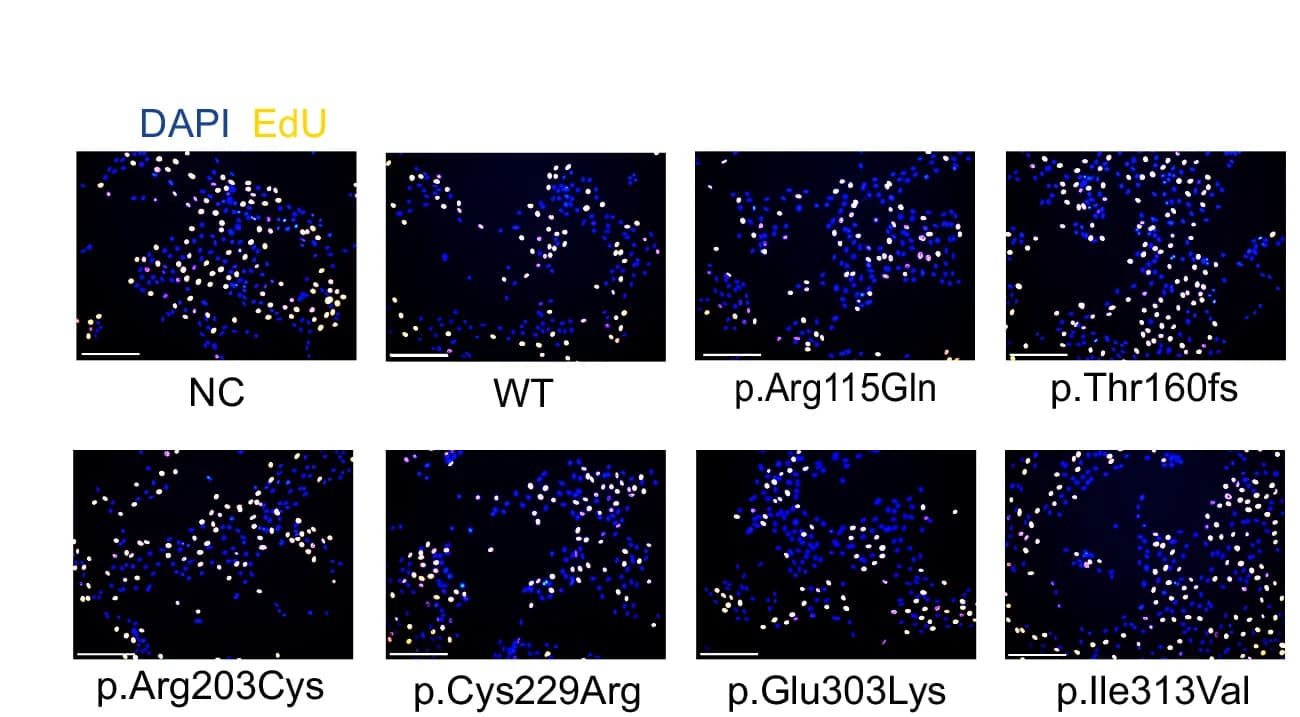 Open access visualization of Microscopy, EdU Assay, KRT32 Mutations, Ker-CT Cell, Cell Proliferation
