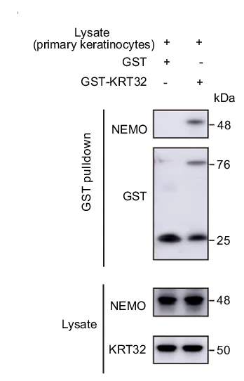 Open access visualization of Gel, GST, GST-KRT32, Primary Keratinocytes, Ker-CT Cells