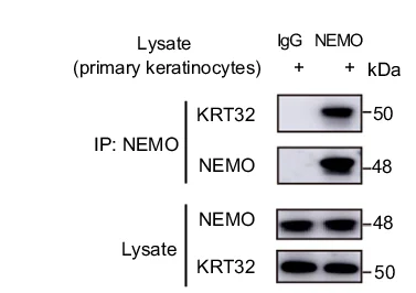 Open access visualization of Gel, Co-IP Analysis, NEMO, Anti-NEMO Antibody, Primary Keratinocytes