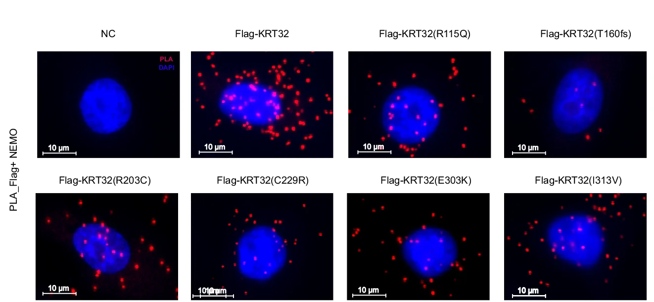 Open access visualization of Microscopy, PLA Analysis, Flag-Tagged KRT32, NEMO, Ker-CT Cells