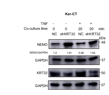 Open access visualization of Gel, Immunoblotting, NEMO, Ker-CT Cells, KRT32