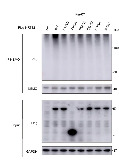 Open access visualization of Gel, Immunoprecipitation, NEMO, Ker-CT Cells, KRT32