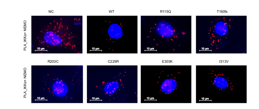 Open access visualization of Microscopy, PLA Analysis, Ker-CT Cells, KRT32, IKKa