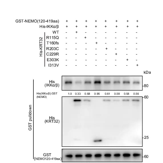 Open access visualization of Gel, Table Image, GST-NEMO, E. coli Extracts, His-KRT32