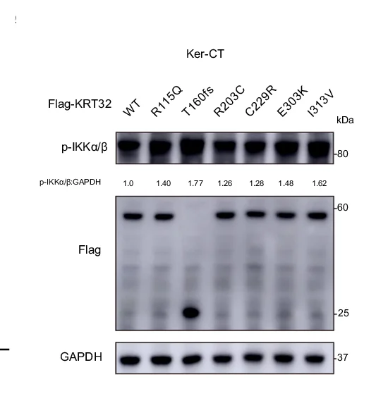 Open access visualization of Gel, Immunoblotting Assay, Phosphorylated IKKa, Phosphorylated IKKb, Ker-CT Cells
